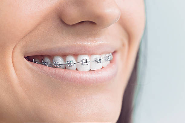 Why Choose Us for Your Dental Needs in Clayton, IN